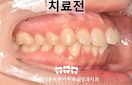 수술전