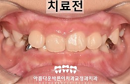 수술전