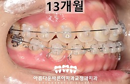 수술후