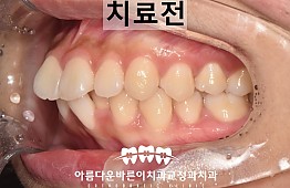 수술전