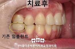 수술후