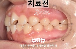 수술전