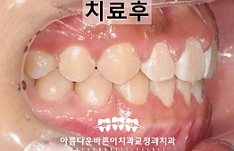 수술후