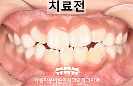 수술전