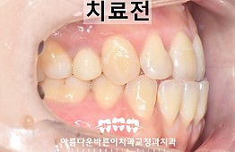 수술전