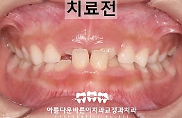 수술전