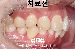 수술전