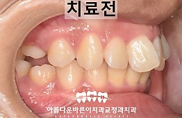 수술전