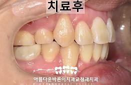 수술후