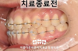 수술후