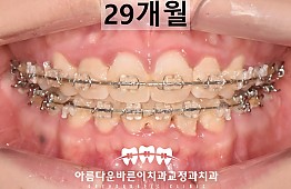 수술후