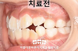 수술전