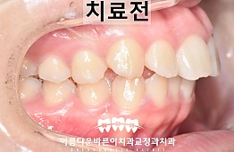 수술전