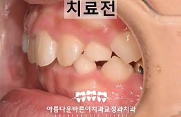 수술전