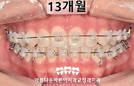 수술후
