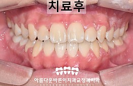 수술후