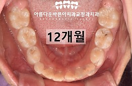 수술후