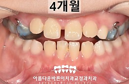 수술후