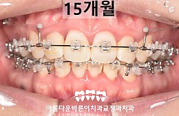 수술후