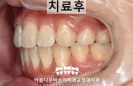 수술후