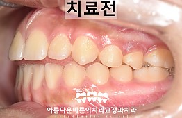 수술전