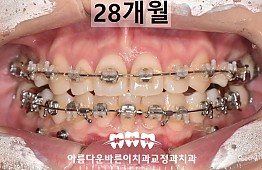 수술후