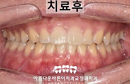 수술후