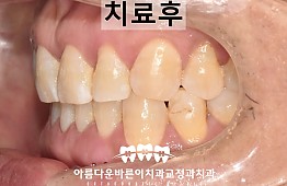 수술후