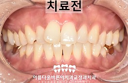 수술전