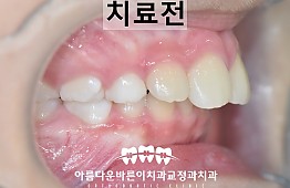 수술전
