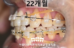 수술후