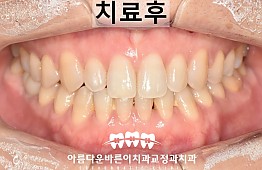 수술후