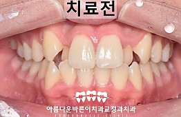 수술전