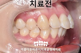 수술전