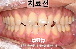 수술전