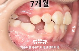 수술후