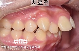 수술전