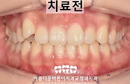 수술전