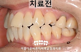 수술전