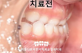 수술전