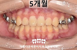 수술후