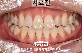 수술전