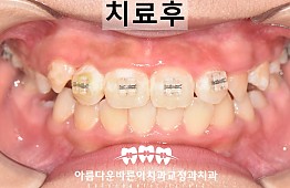 수술후