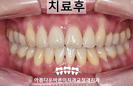 수술후