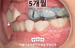 수술후