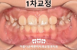 수술후