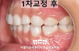 수술후