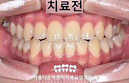 수술전