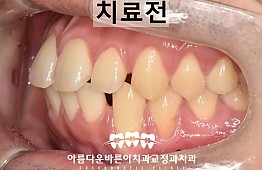 수술전