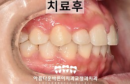 수술후